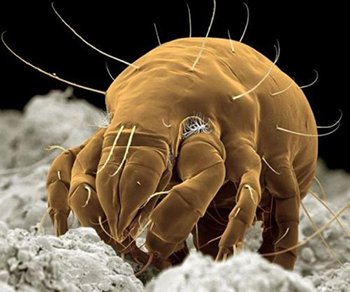 高倍显微镜下的螨虫疥螨成虫体近圆形或椭圆形,背面隆起,乳白或浅黄色